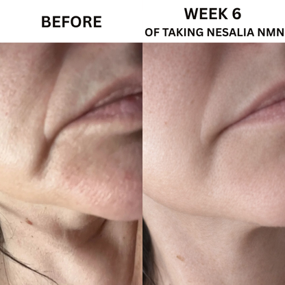 Nesalia NMN 10-in-1 For Jowls & Jawline Tightening