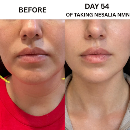 Nesalia NMN 10-in-1 For Jowls & Jawline Tightening