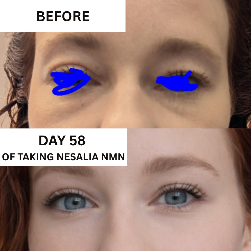 Nesalia NMN 10-in-1 For Puffy Eyes