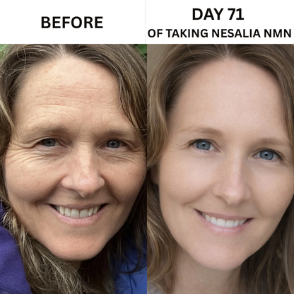 Nesalia NMN 10-in-1 For Wrinkles & Fine Lines