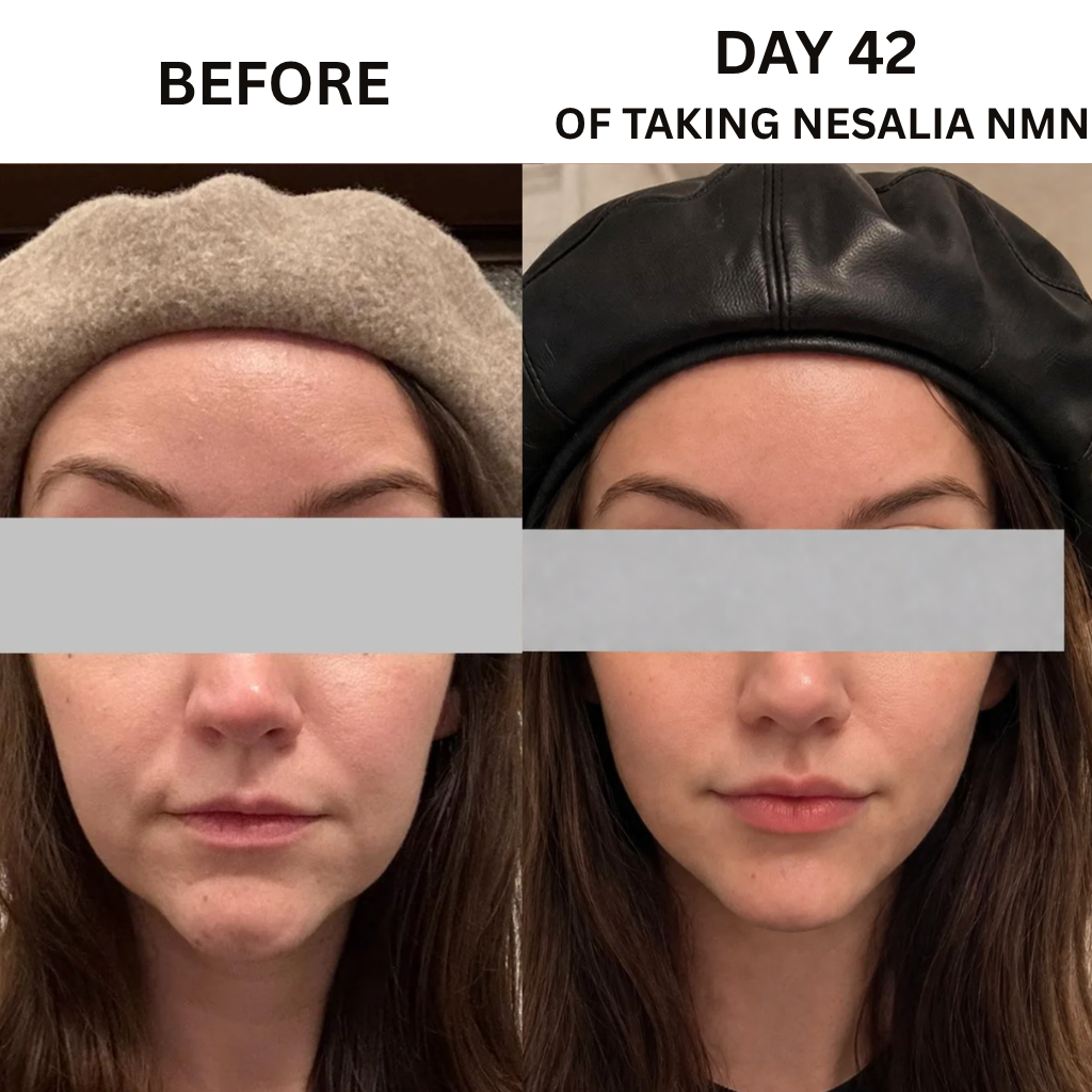 Nesalia NMN 10-in-1 For Jowls & Jawline Tightening