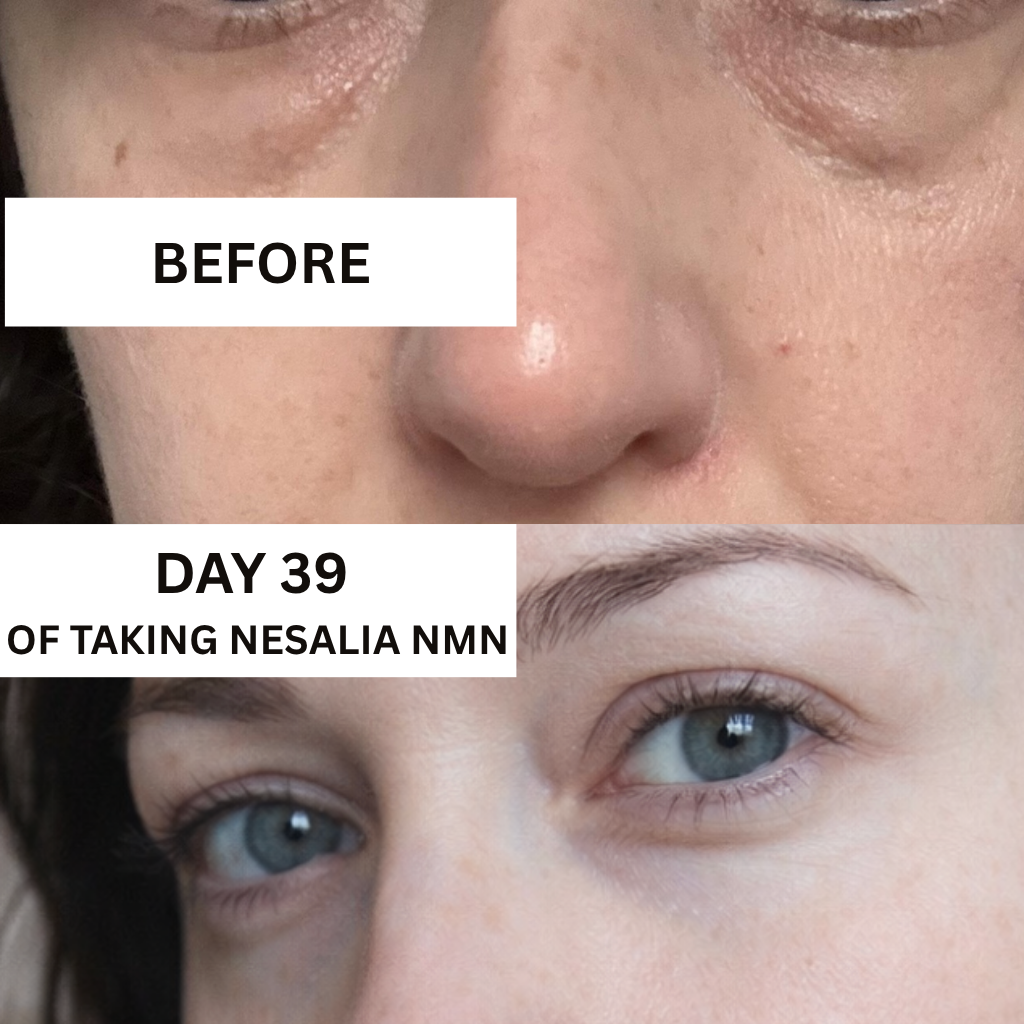 Nesalia NMN 10-in-1 For Puffy Eyes