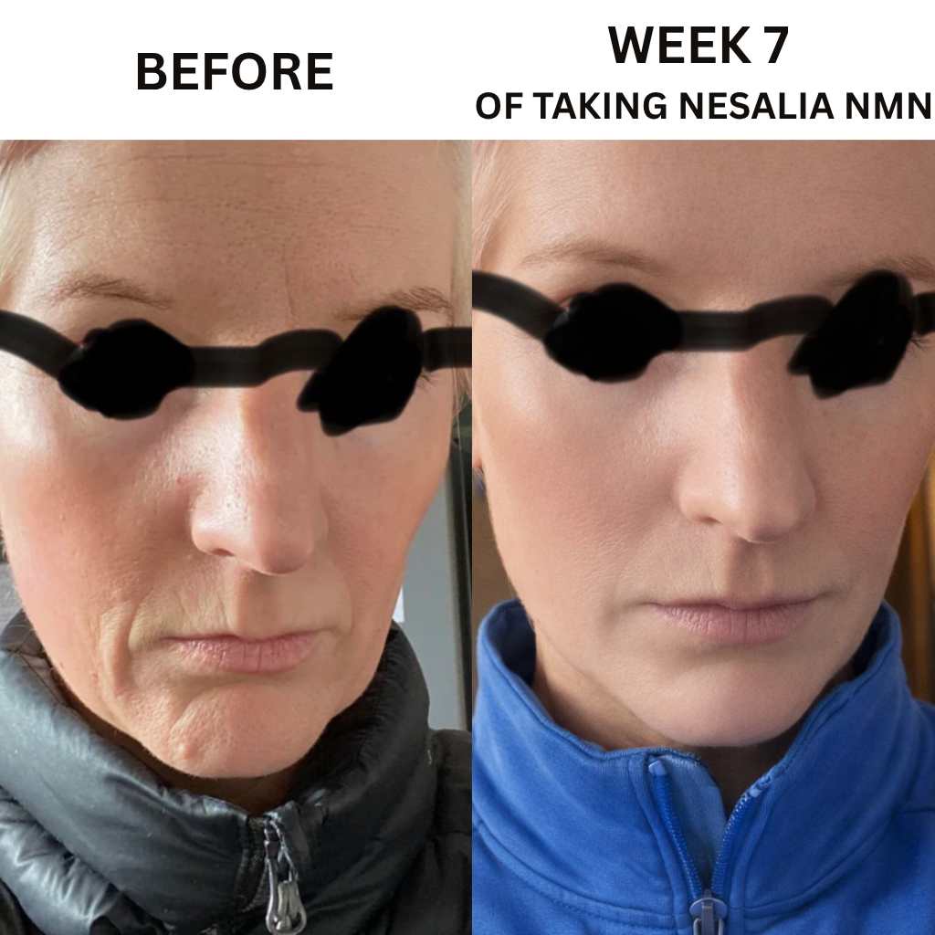 Nesalia NMN 10-in-1 For Jowls & Jawline Tightening
