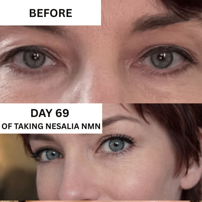 Nesalia NMN 10-in-1 For Hooded Eyes