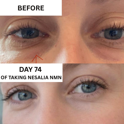 Nesalia NMN 10-in-1 For Puffy Eyes