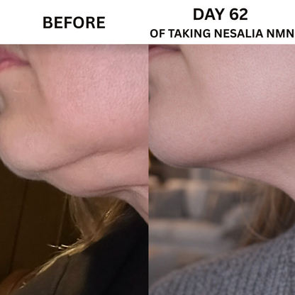 Nesalia NMN 10-in-1 For Jowls & Jawline Tightening