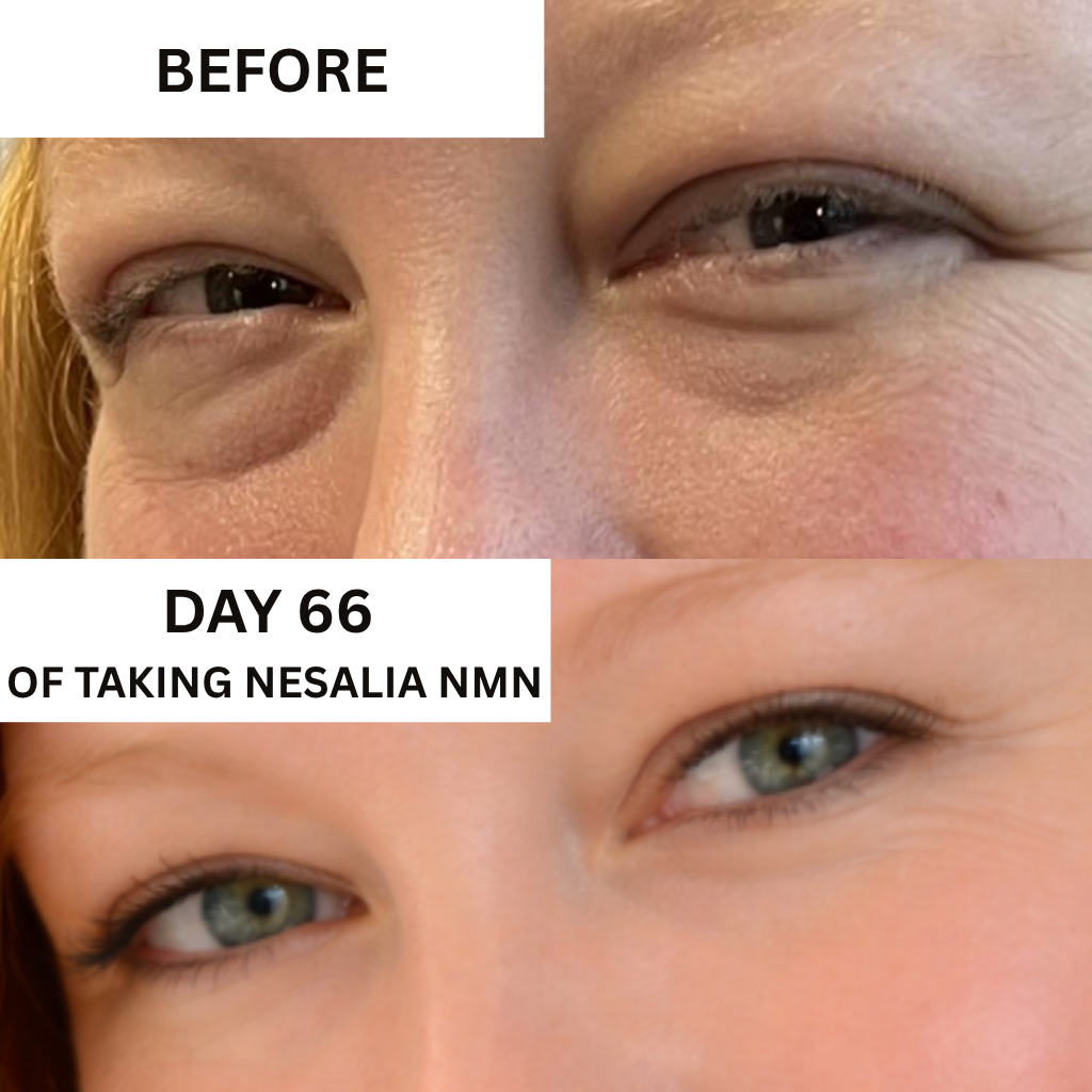 Nesalia NMN 10-in-1 For Puffy Eyes