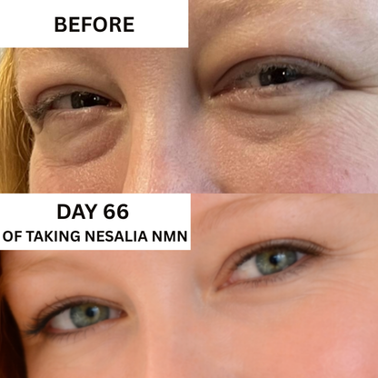 Nesalia NMN 10-in-1 For Puffy Eyes