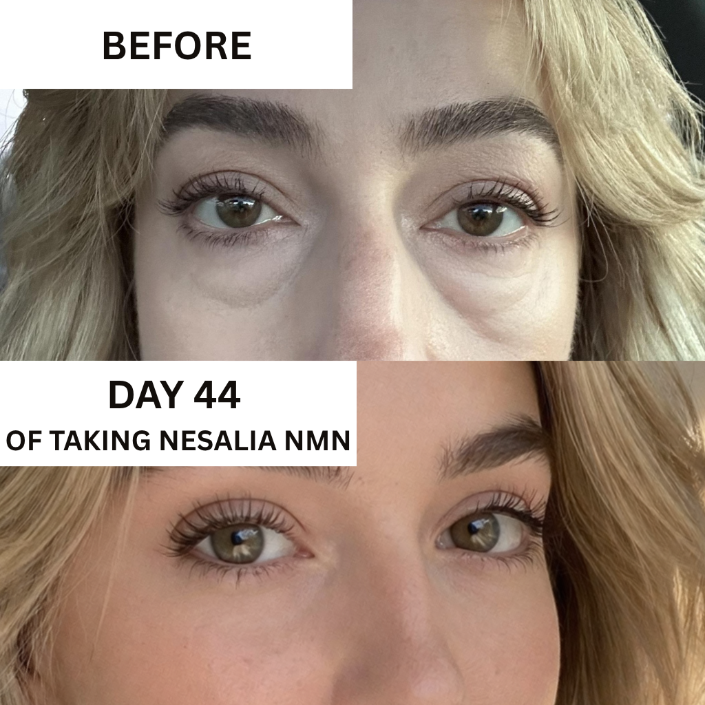 Nesalia NMN 10-in-1 For Puffy Eyes