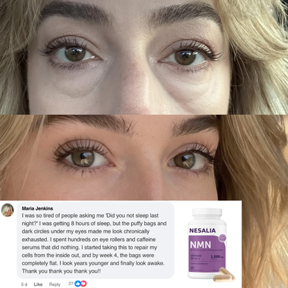 Nesalia NMN 10-in-1 For Puffy Eyes